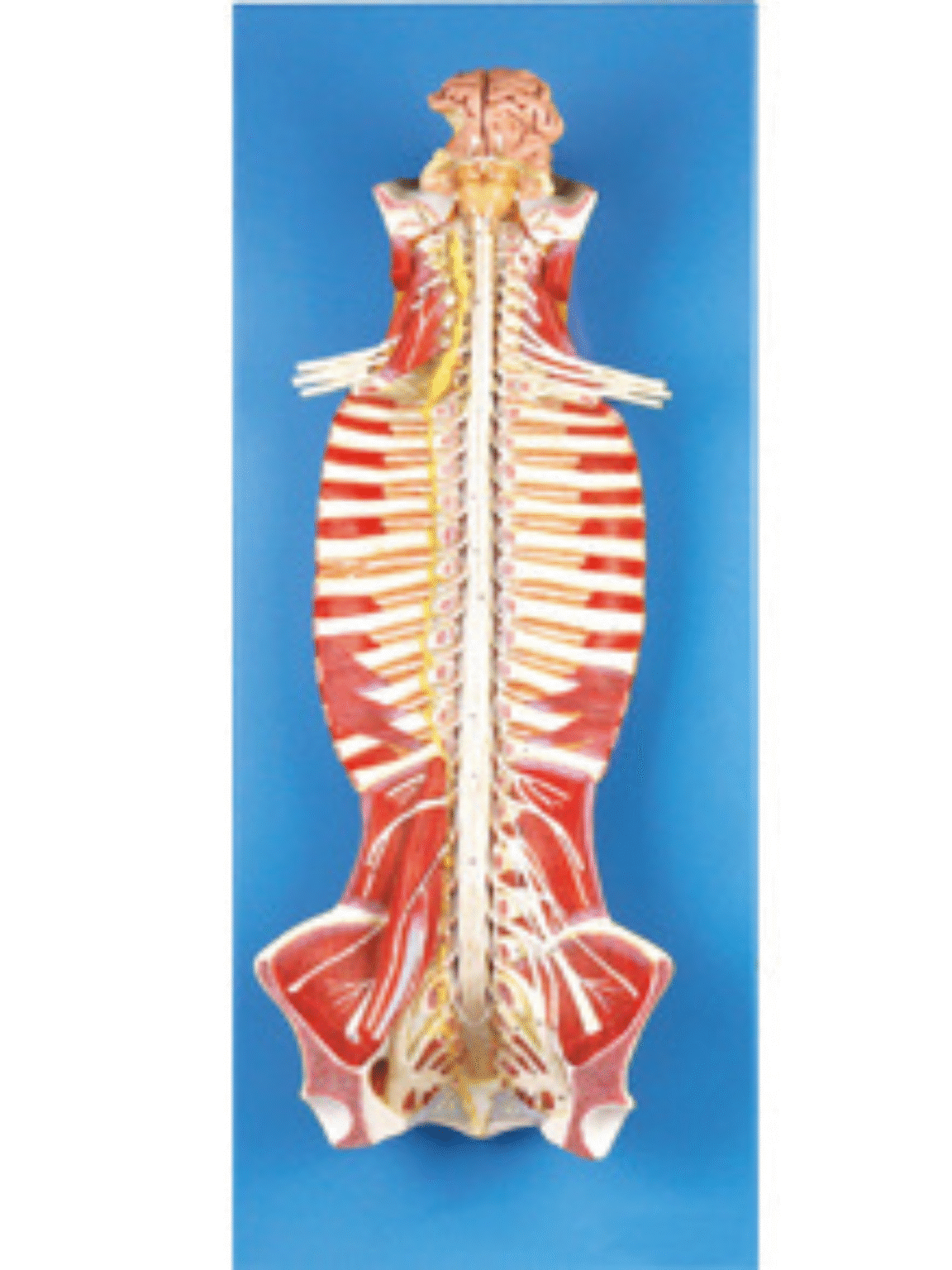 ATL-134 SPINALCORD IN THE SPINAL CANAL SOFT – Atlas Corporation