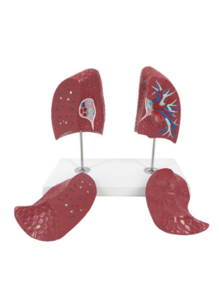 ATL-197 HUMAN LUNGS 2 PARTS