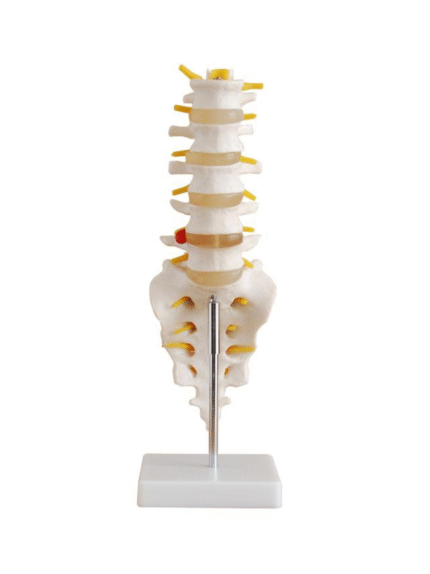 ATL-230 LIFE SIZE LUMBER VERTEBRAVE WITH SACRUM COCCYX &HENATED DISC