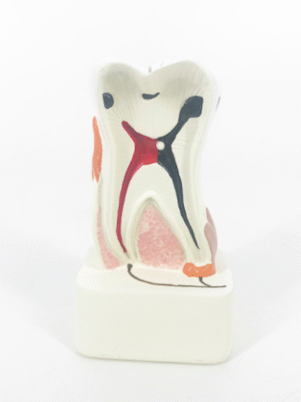 ATL-244 DISSECTED MODEL OF DENATAL DIASES