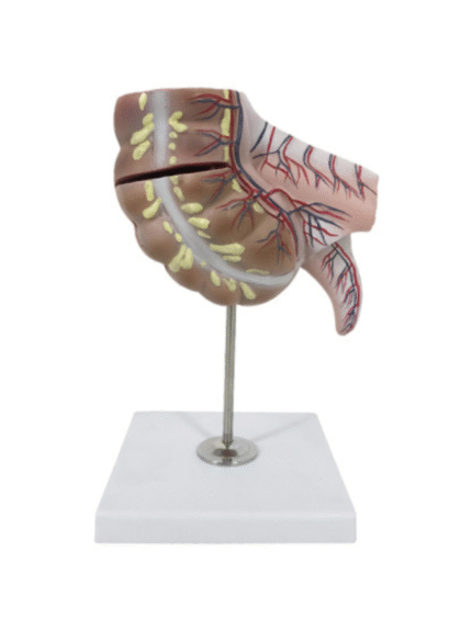 ATL-146 APPENDIX AND CAECUM SOFT